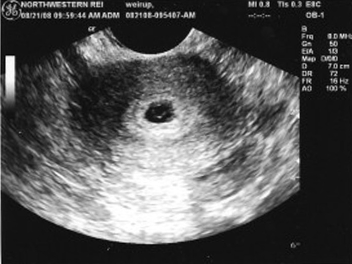 Двухнедельный зародыш