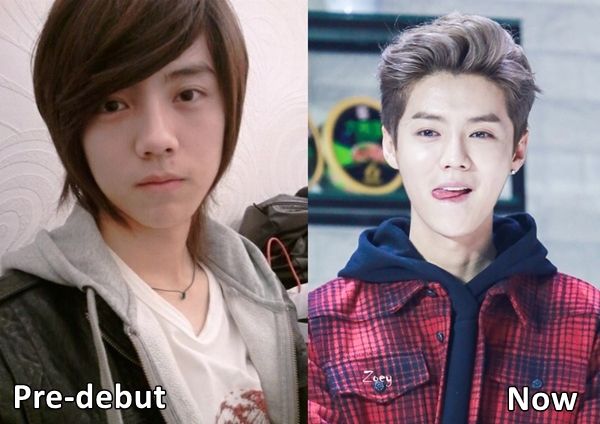Корейские актеры до и после пластики