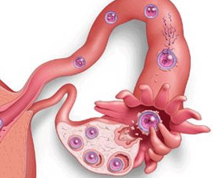 признаки имплантации эмбриона в матку 
