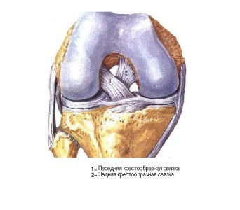 Передняя крестообразная связка коленного сустава. Крестовина связка коленного сустава. Передняя крестовина связка коленного сустава. Мышцами – стабилизаторами передней крестообразной связки. Перелом крестообразной связки.