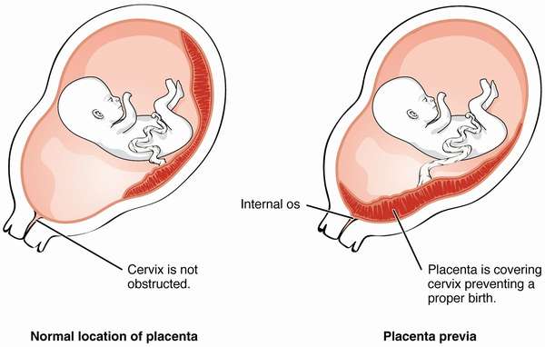 Благодаря современных технологиям обнаружить процесс старения плаценты можно на ранних стадиях 