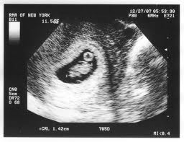 7 недель мальчику. УЗИ на 7 акушерской неделе беременности. УЗИ на седьмой акушерской неделе беременности. УЗИ ребенка на 7 неделе беременности. УЗИ 7 недель беременности фото.