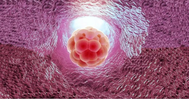 Имплантация эмбриона – признаки начинающейся беременности